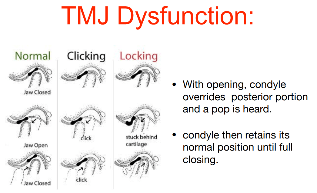 Utilize Laser Therapy for Headaches, Neck & Jaw Pain